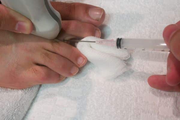 Mortons neuroma treatment